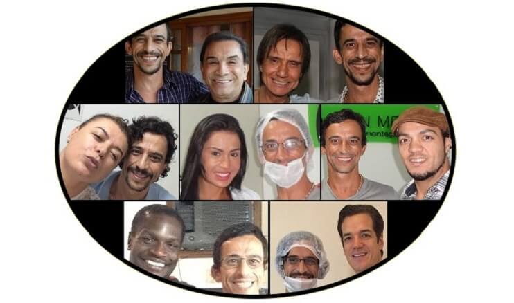 famosos com micropigmentação capilar
