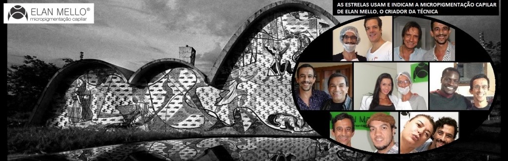 Elan Mello Micropigmentação Capilar em Belo Horizonte BH | Os famosos fazem a Micropigmentação Capilar com Elan Mello